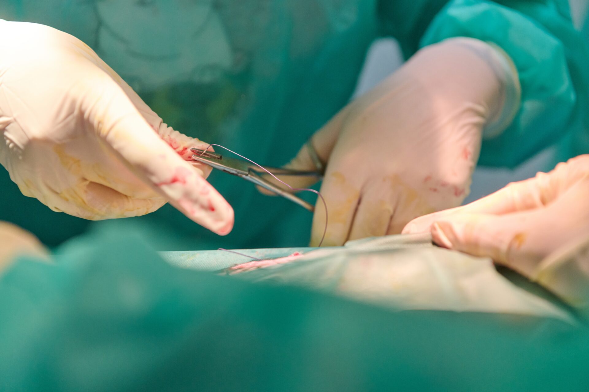 美容整形後の傷跡に対する修正手術を行う様子