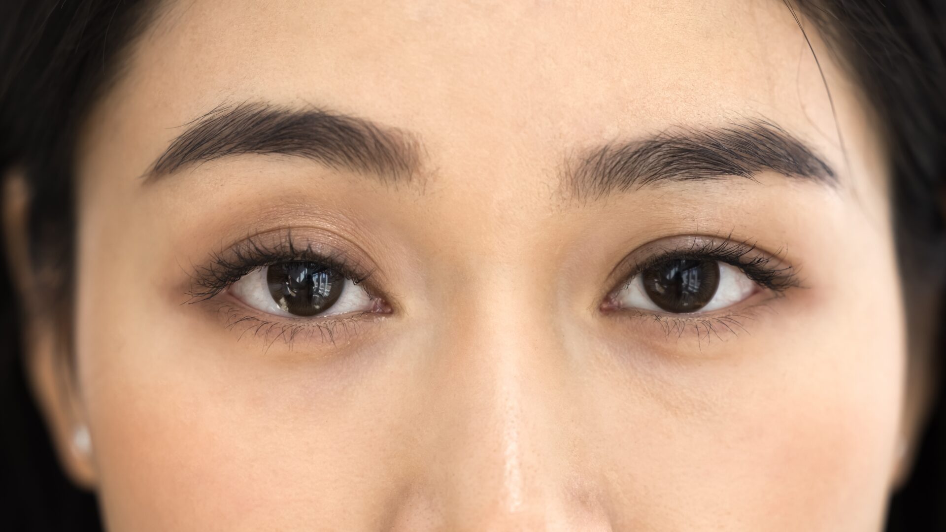 二重切開の修正手術：後悔を希望に変える！方法・費用・ダウンタイム・名医ガイド