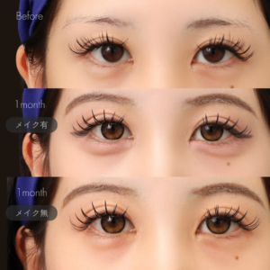 グラマラスライン形成