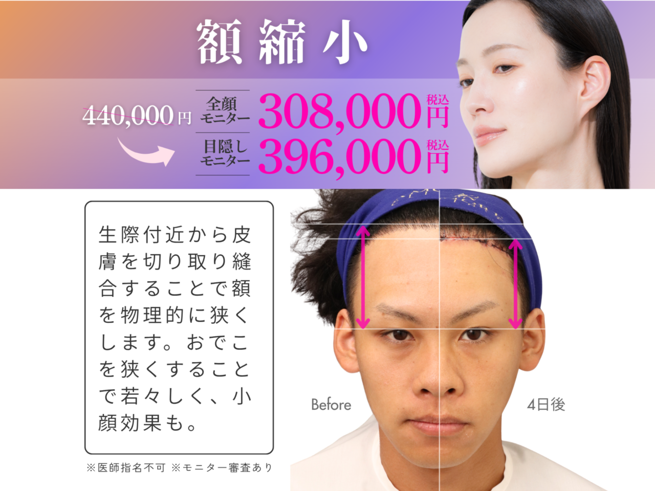 キャンペーン情報