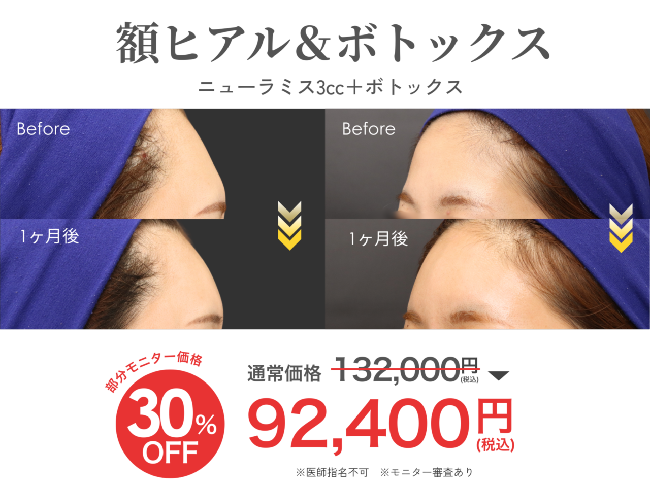 キャンペーン情報