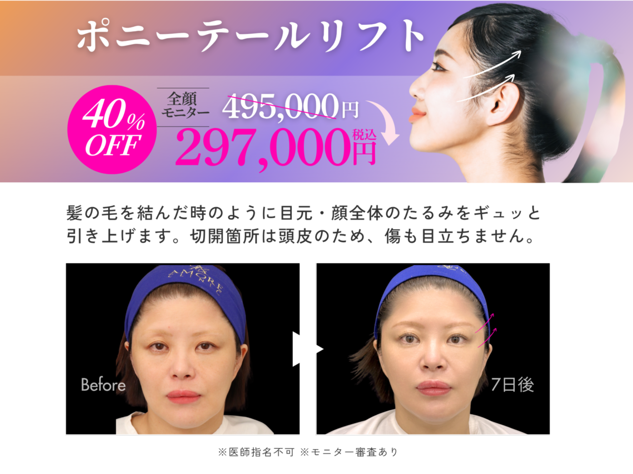 キャンペーン情報