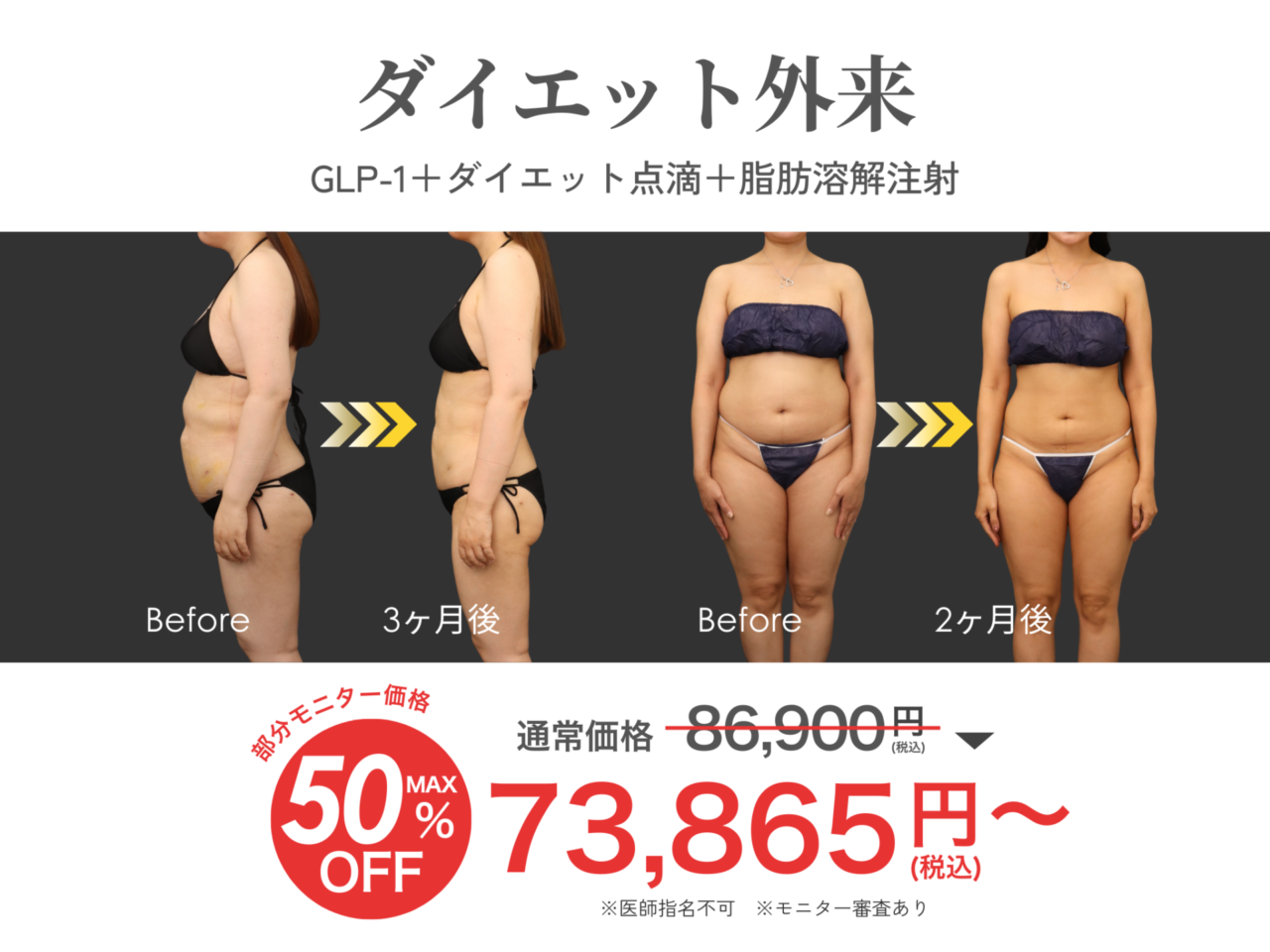 キャンペーン情報