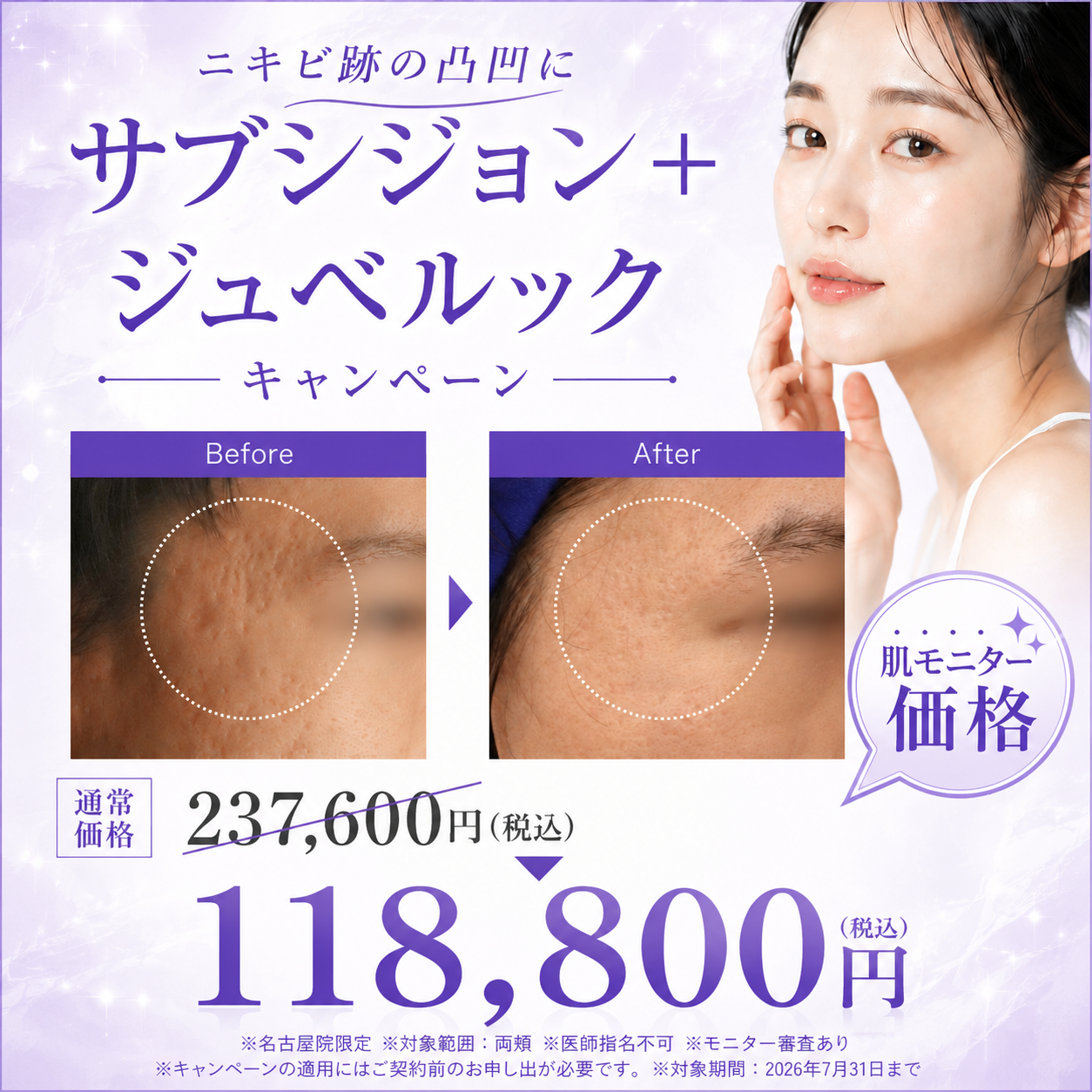 キャンペーン情報