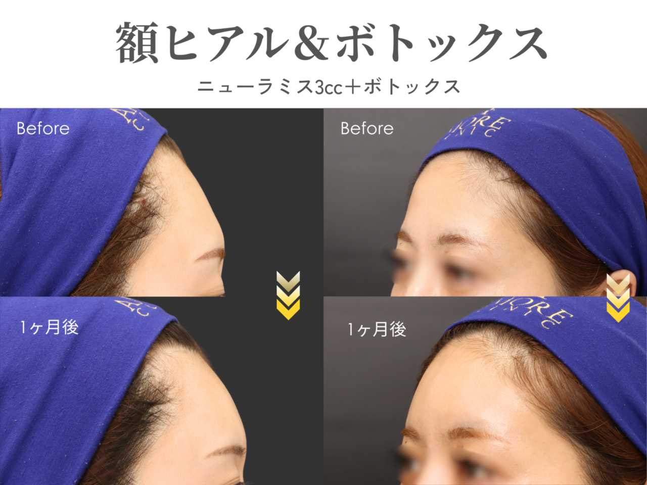 今月のイチオシ施術