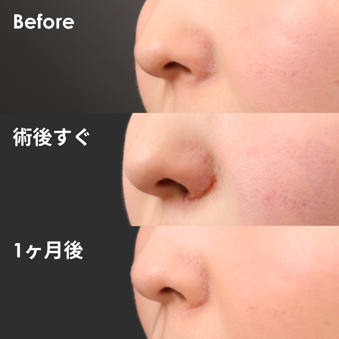 グラデーション加工