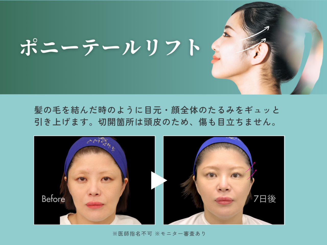 今月のイチオシ施術
