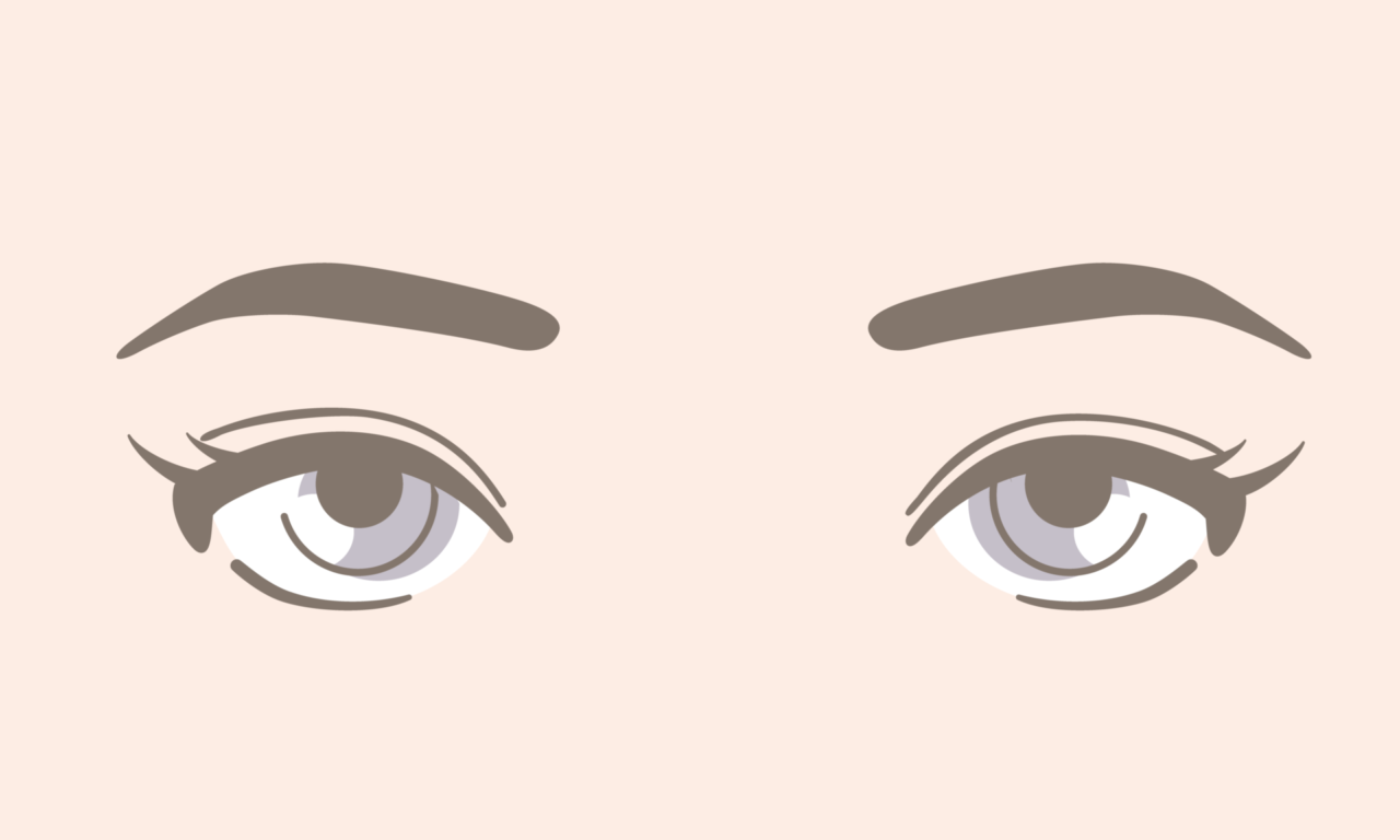 二重全切開・眼瞼下垂の修正