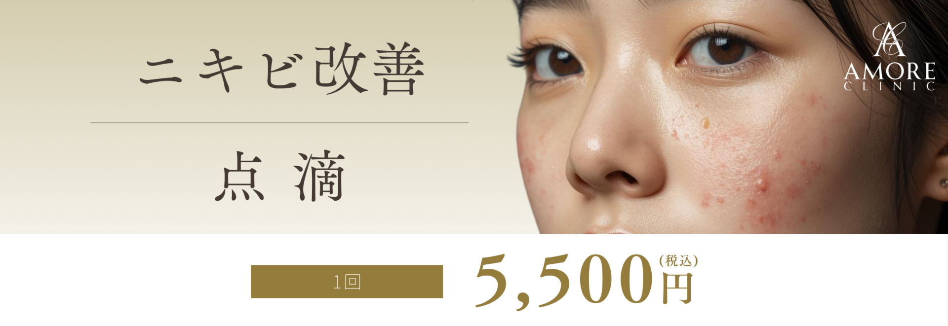 ニキビ改善点滴