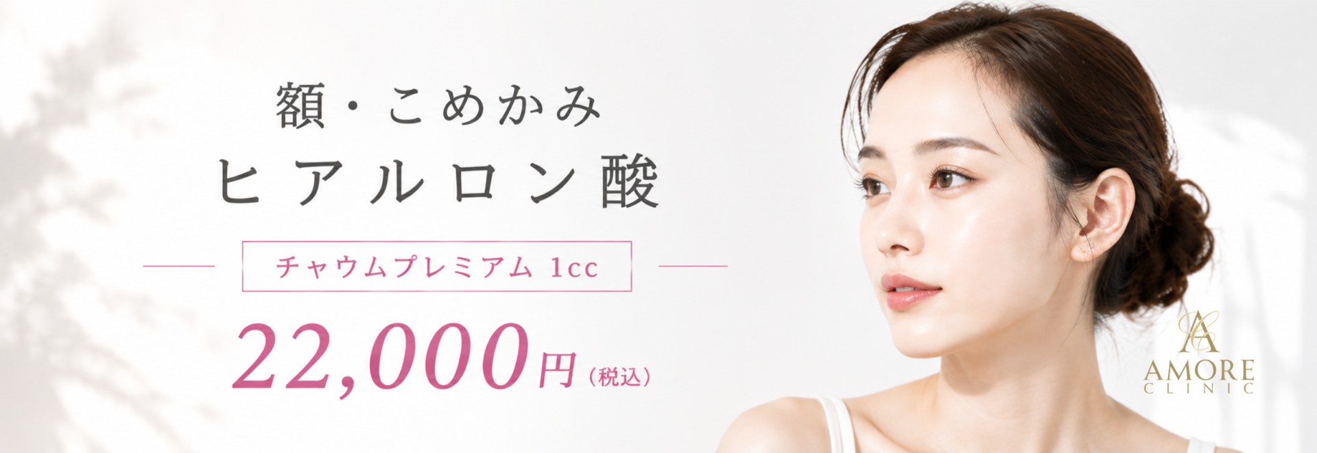 額・こめかみヒアルロン酸