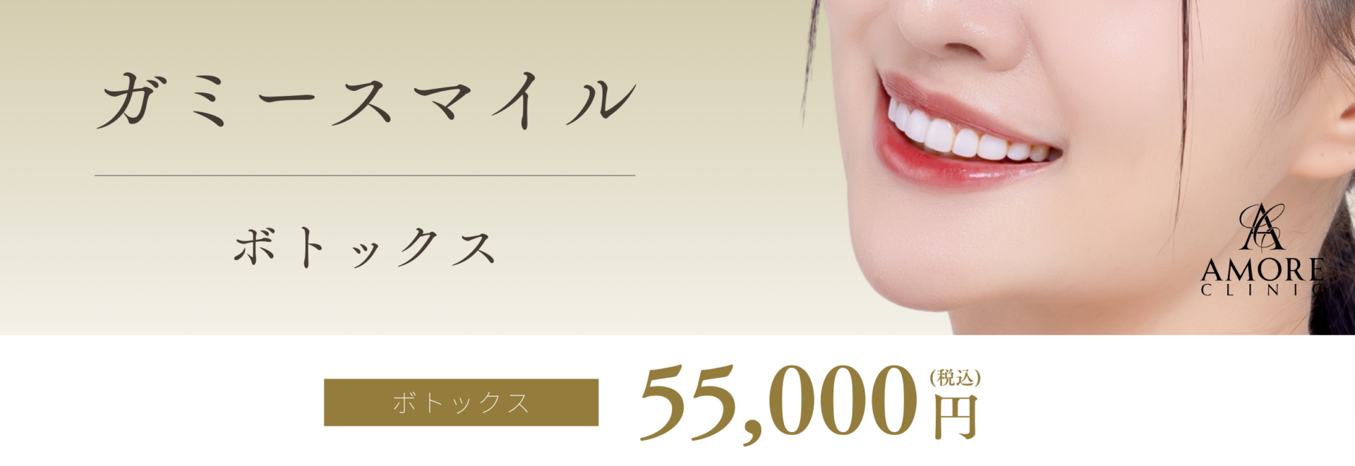 ガミースマイルボトックス