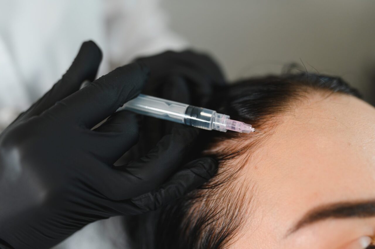 頭皮汗止めボトックス