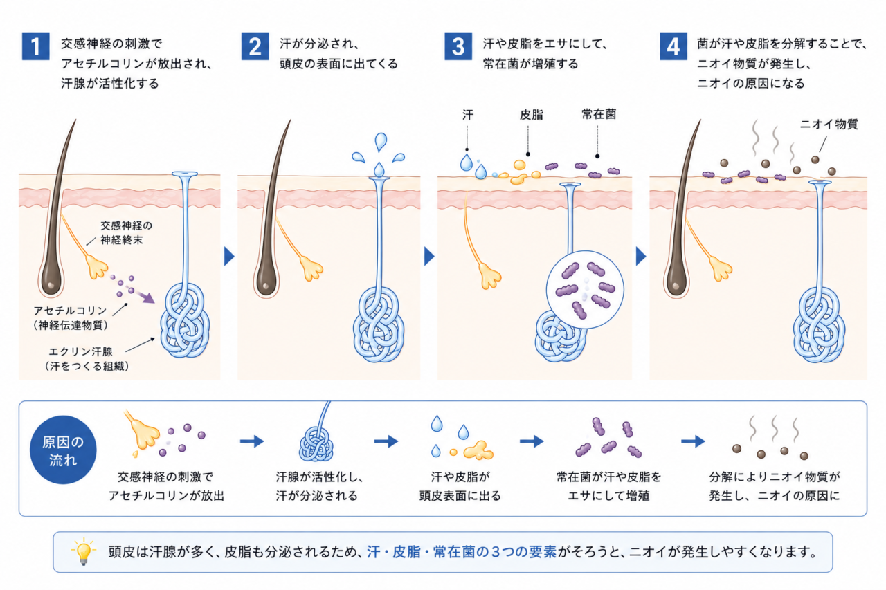 頭皮汗止めボトックス