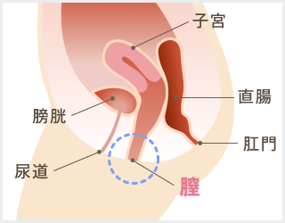 膣縮小