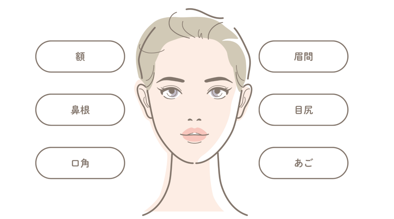 ボトックス・ボツリヌストキシン注射
