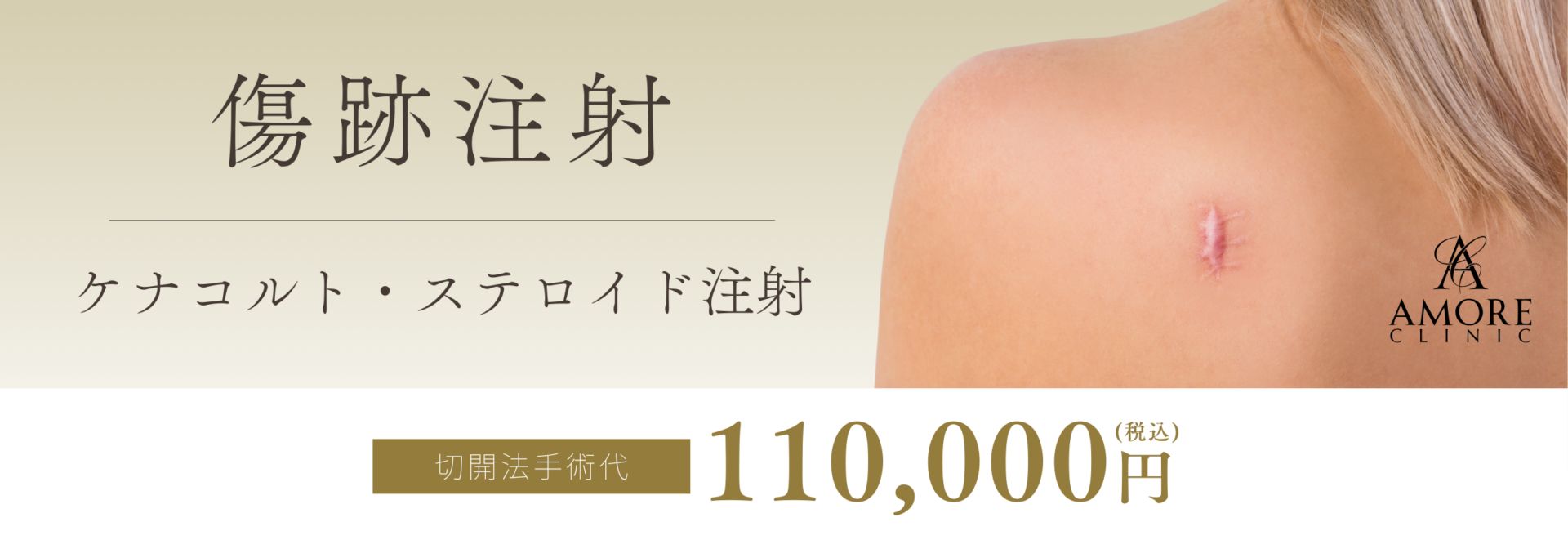 傷跡注射