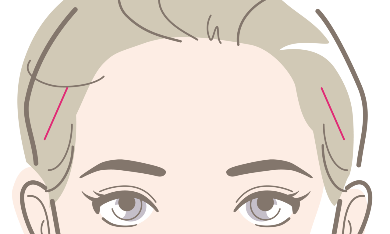 ポニーテールリフト