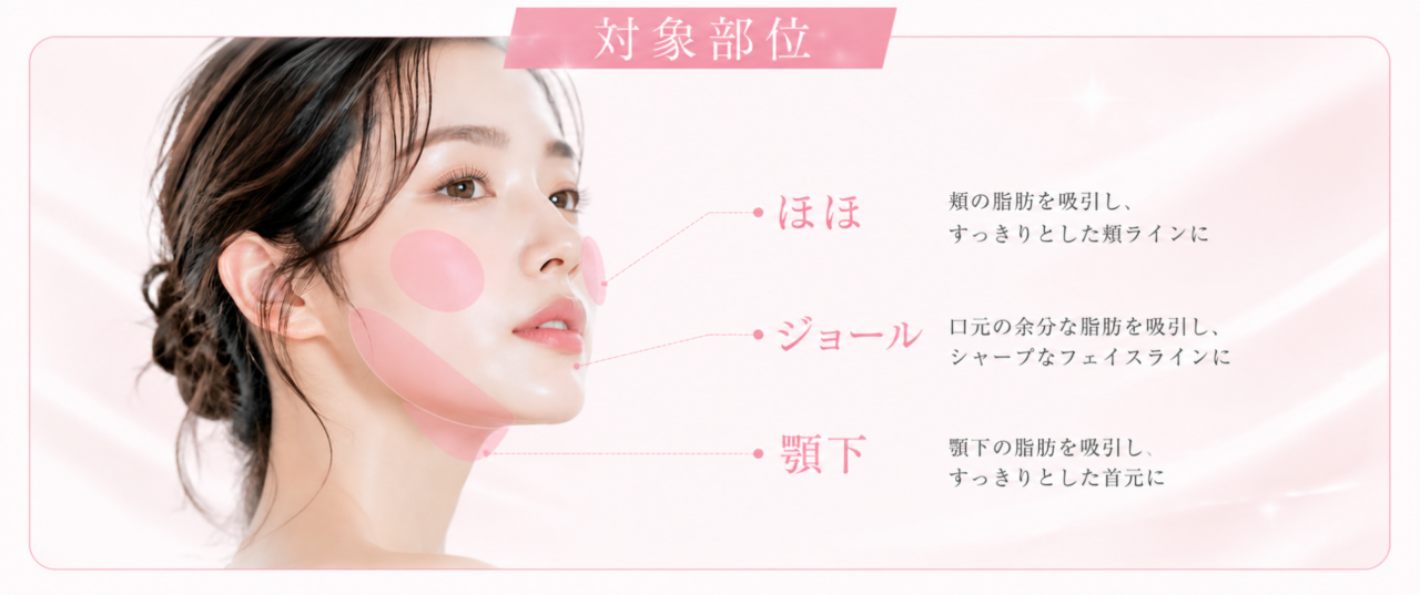 脂肪吸引注射