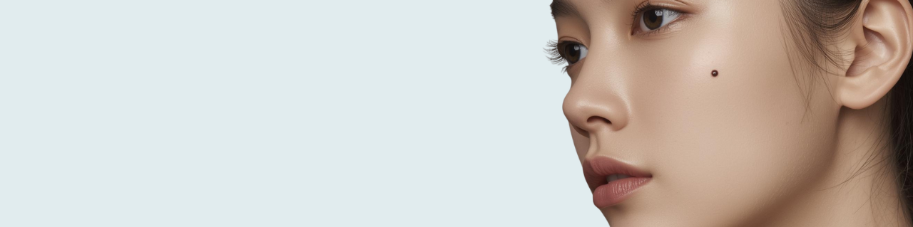 ほくろ・イボ取り