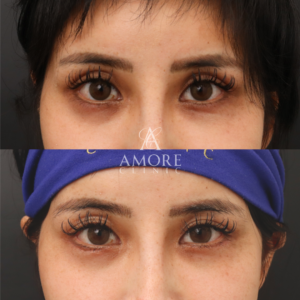 リズネ（手打ち）