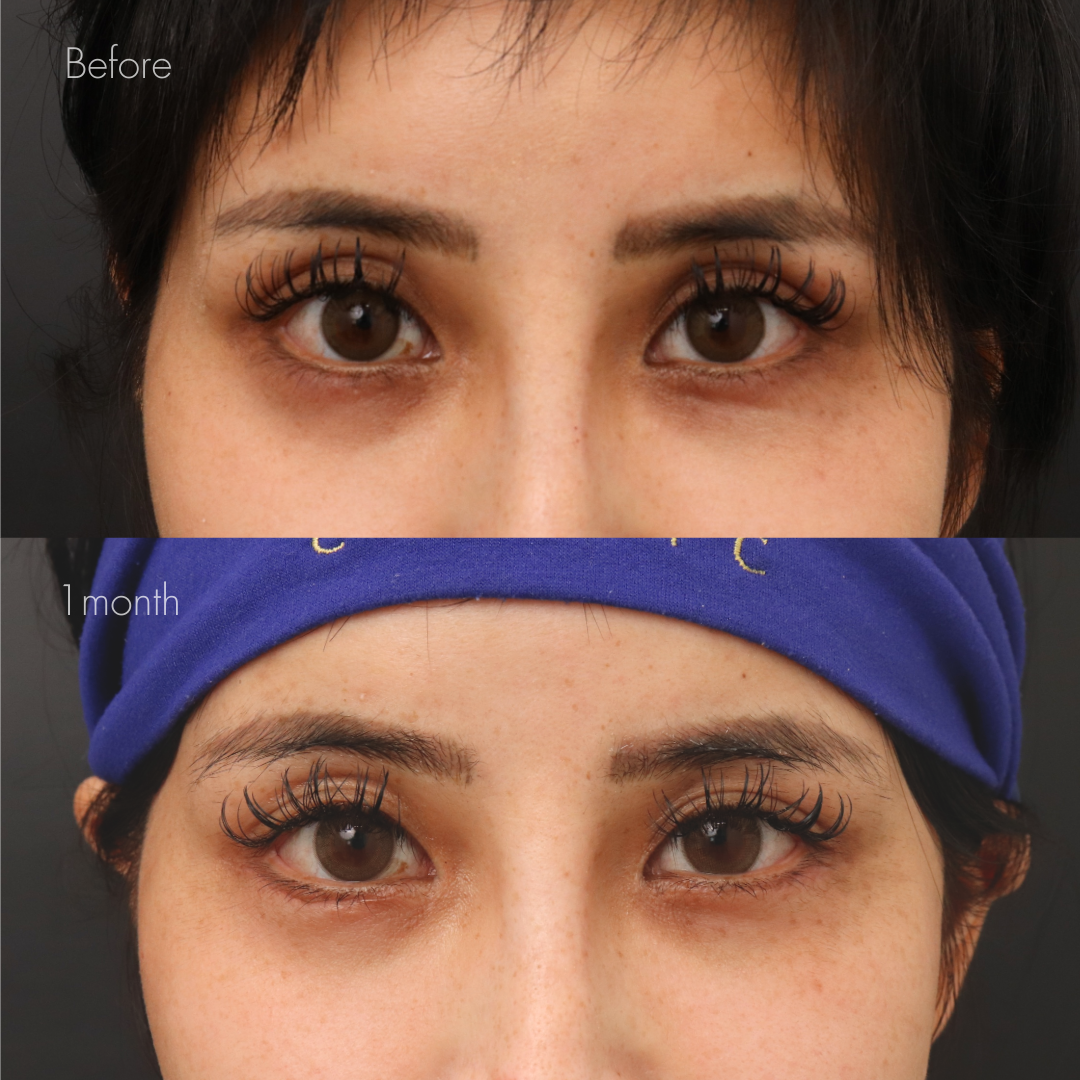 リズネ（手打ち）