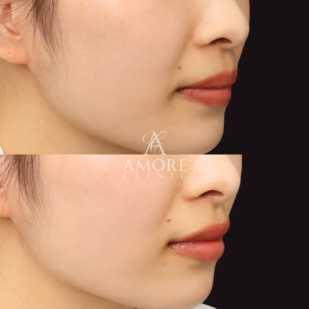 猫ヒアルロン酸