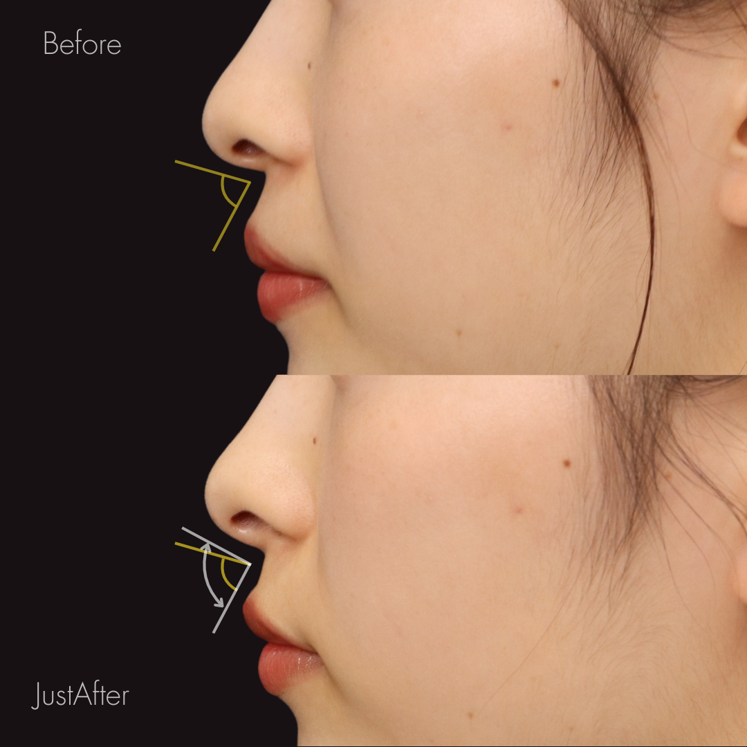 猫ヒアルロン酸