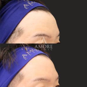 リズネ（手打ち）