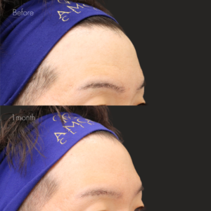 リズネ（手打ち）