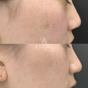 ハリウッドスペクトラ（スポット）