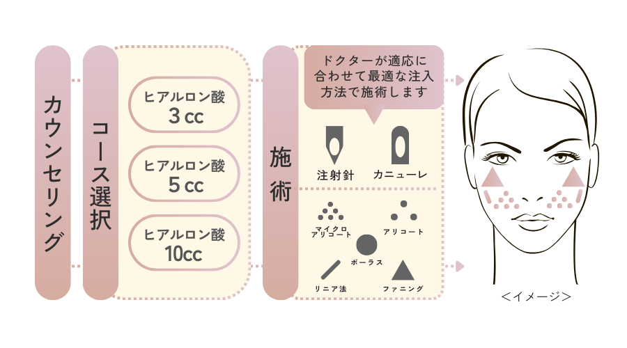 オーダーメイドヒアルリフト