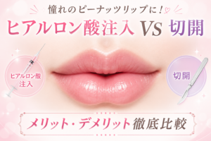憧れのピーナッツリップに！ヒアルロン酸注入 vs 切開、メリット・デメリット徹底比較