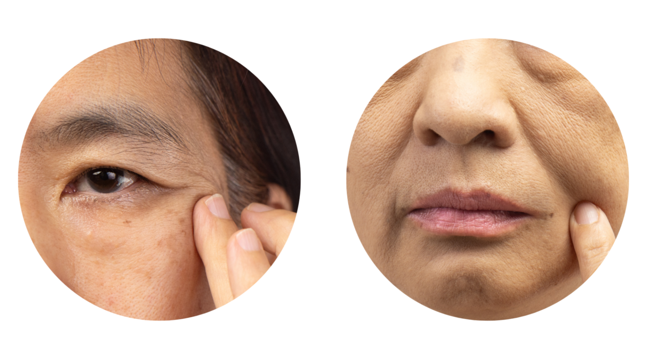 ポニーテールリフト