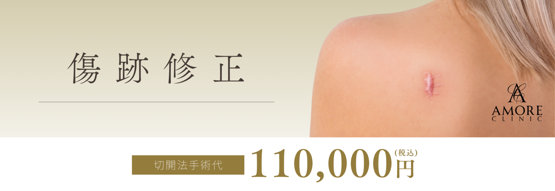 傷跡修正