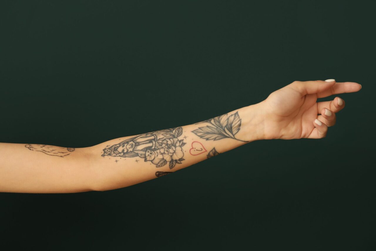 タトゥー・刺青除去(手術)