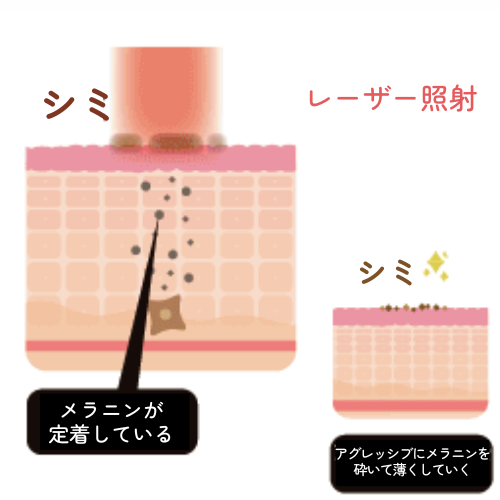 ハリウッドスペクトラ