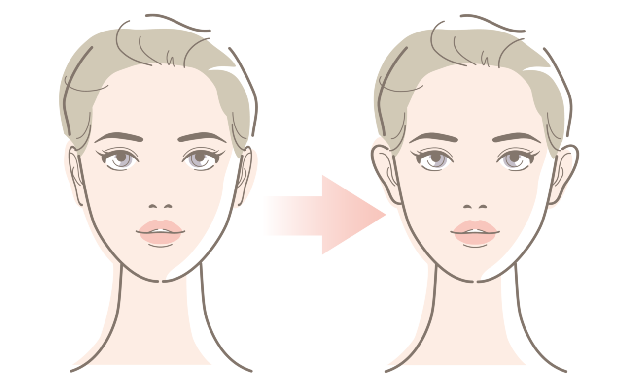 立ち耳ヒアルロン酸