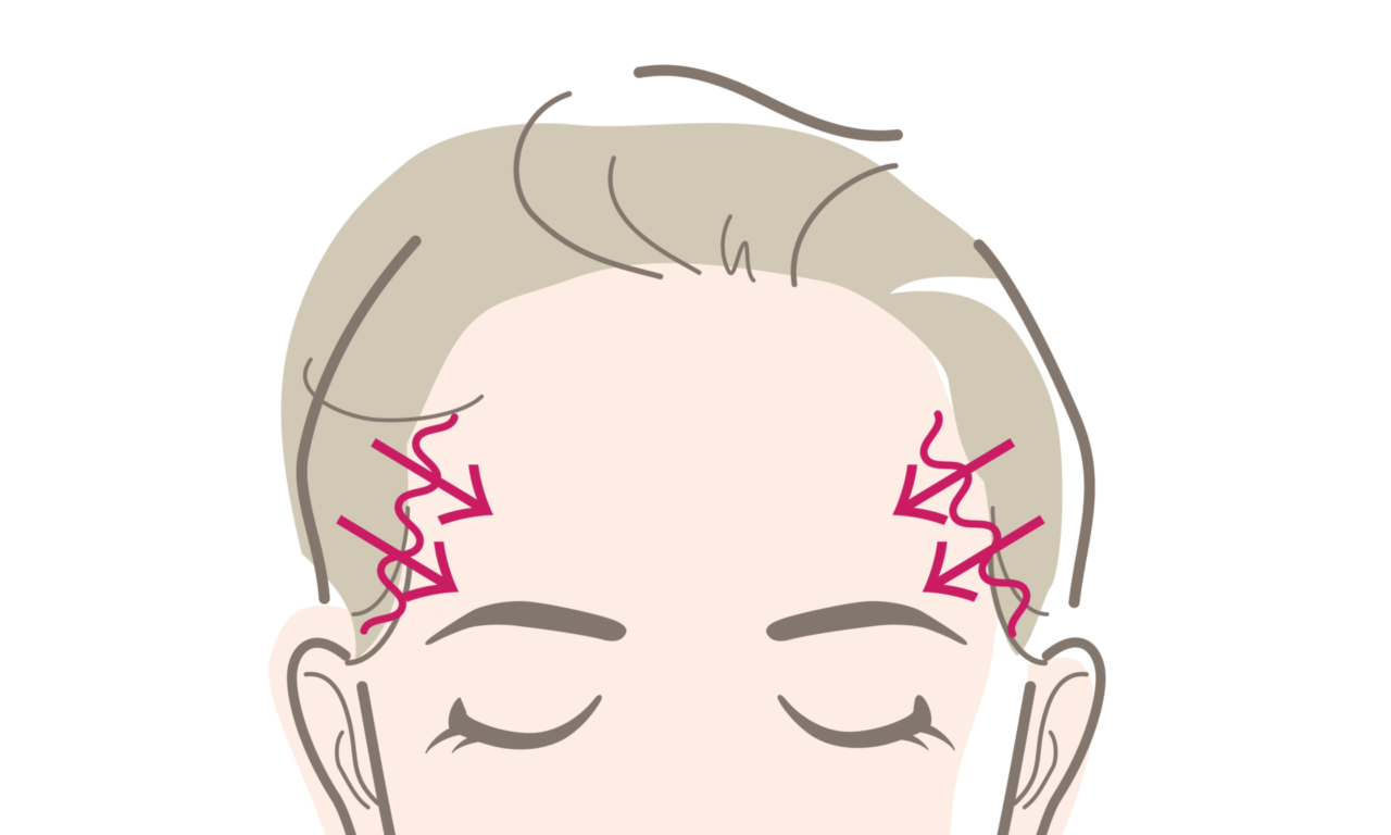 こめかみ縮小