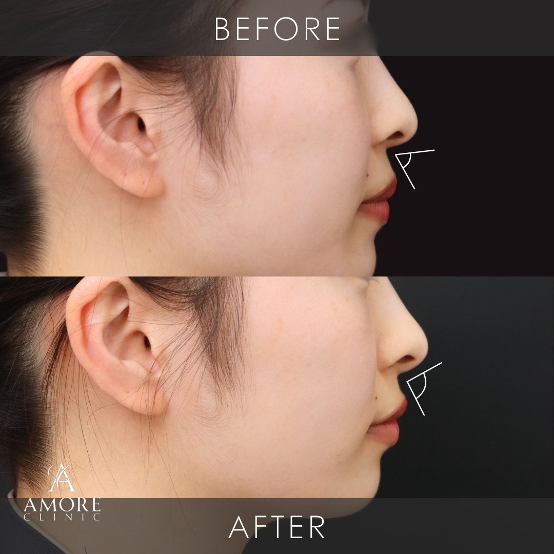 猫ヒアルロン酸