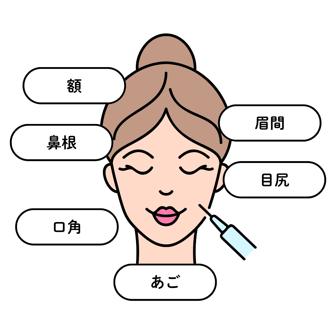 しわ改善ボトックス