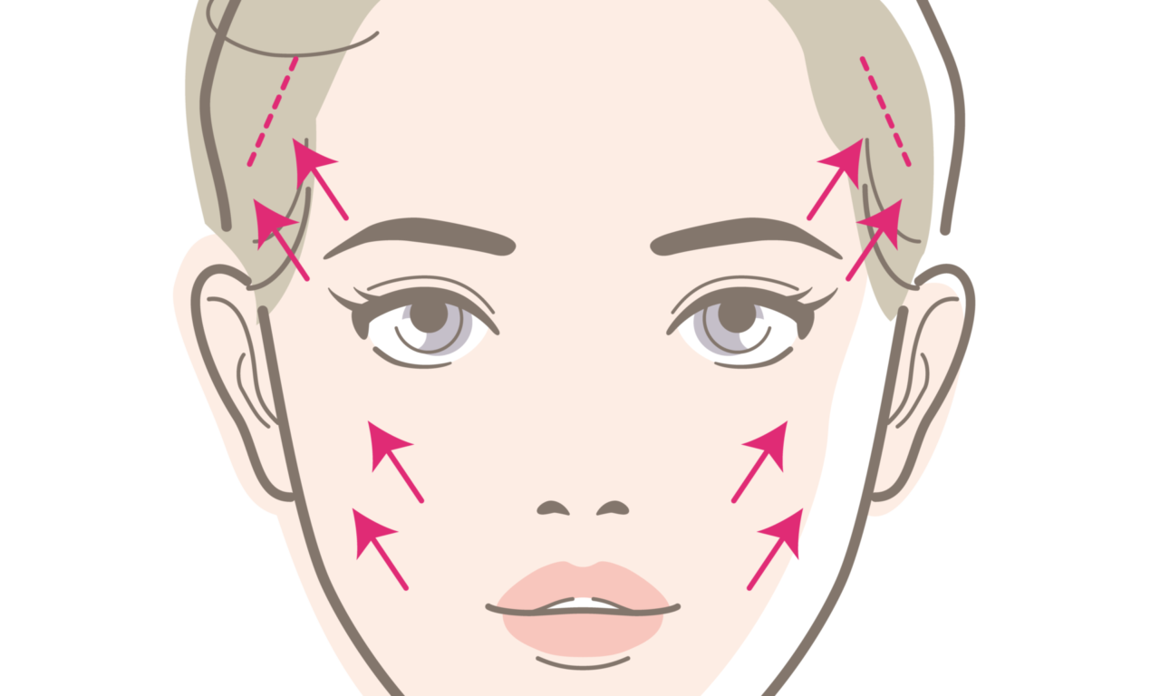 ポニーテールリフト