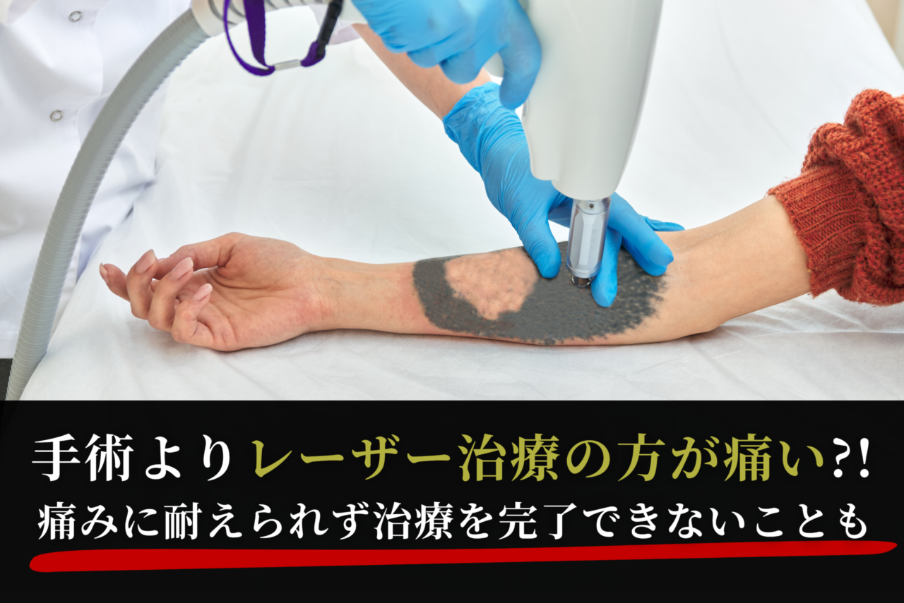 タトゥー・刺青除去(手術)