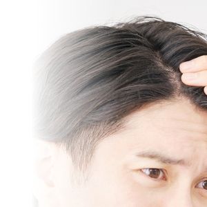 男性の薄毛・AGA治療