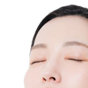 額・こめかみヒアルロン酸